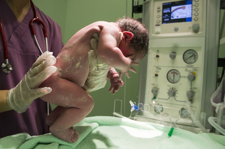 Qué-factores-de-riesgo-aumentan-la-probabilidad-de-nacimiento-prematuro